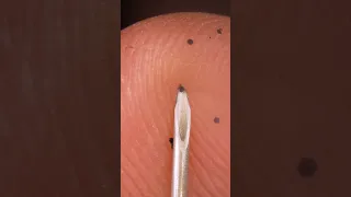 ASMR syringe under index finger skin CLOSE-UP macro - zoom in
