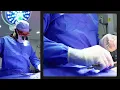 Thinking About a Tummy Tuck Here s What to Expect with Dr Triggs