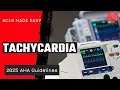 ACLS 2025 - Tachycardia Algorithm