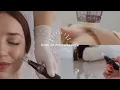 How to Microneedle