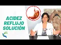Download Lagu HARDBRAND en REFLUX - Verschillen en HUISVERZORGING Voeding Fisiolution fysio-oplossing