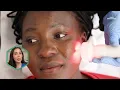 A dermatologist explains how red light therapy works | SELF IMPROVED