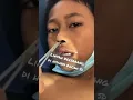 lintah bersarang di hidung bocah SD #shorts #viral