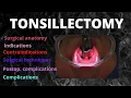 066 Tonsillectomy