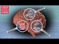 LOOKING INSIDE THE BRAIN An overview of Brain Scanning Investigation techniques