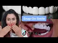Orthodontist Reacts To Snap-On Veneer Tik-Tok s