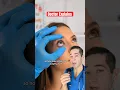 How does LASIK work