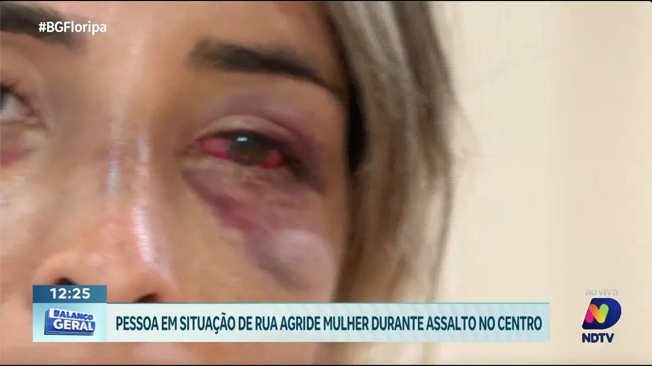 Pessoa em situação de rua agride mulher em assalto no centro de Florianópolis