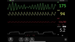 Hospital Monitor Part 2 - ICU