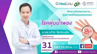 สาเหตุของโรคตุ่มน้ำพองคืออะไร
