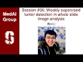 MedAI Weakly supervised tumor detection in whole slide image analysis Bin Li