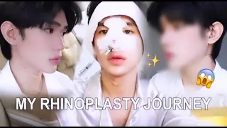 Download MY RHINOPLASTY JOURNEY MP3