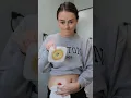 Download Lagu Realistic Ostomy Change - When Your Stoma is a Volcano | #ostomy | Let's Talk IBD