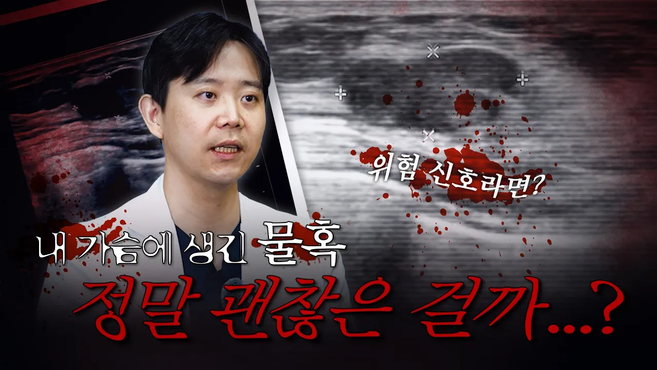 가슴에 '이것' 생겼으면 당장 오세요