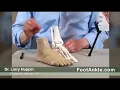 Why Does My Ankle Still Hurt Months After I Sprained It?
