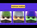 How should I go through Mehlmanmedical HY Arrows PDF