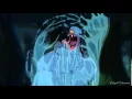 Download Lagu [Hercules fandub] Meg meets Hercules
