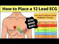 12 Lead ECG Placement MADE EASY EMT Nursing Paramedic