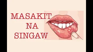masakit na singaw payo ni doc willie ong 50