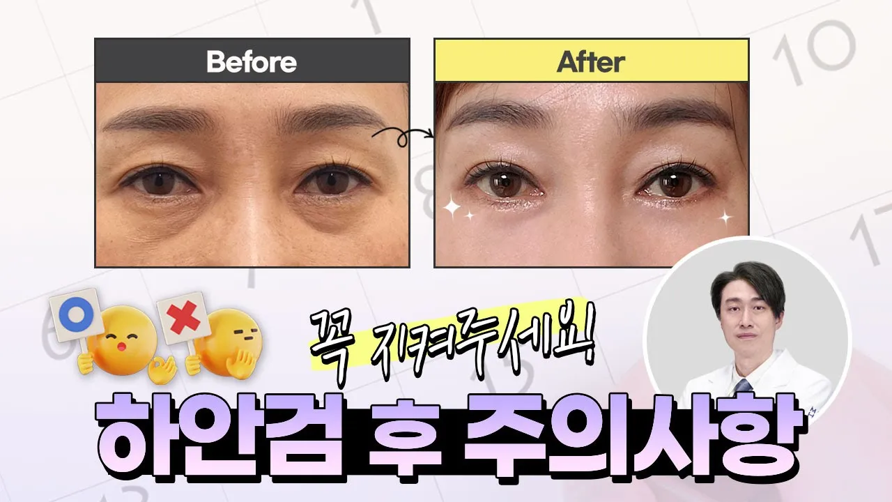 💛하안검 수술 후 주의사항📌(👁‍🗨제대로 효과 보려면 꼭 지켜주세요!)