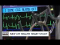 New UW Health study on heart ablation