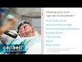 Download Lagu Ceribell Technology in the ICU