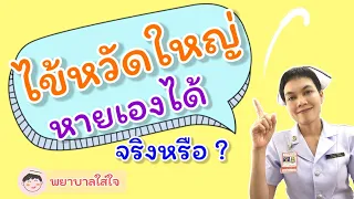 ไข้หวัดใหญ่หายได้เองจริงหรือ