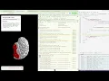 Debugging Brain Region Mapping Semiology Examples JSON Integration SeizureZone Tool Demo
