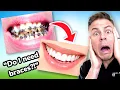 How To Tell If You Need BRACES The ULTIMATE Braces Guide Ep 1
