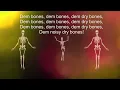 dem bones