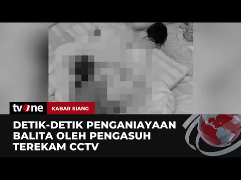 Orang Tua Ungkap Kronologi 2 Balita Dianiaya Pengasuh, Kaki-Tangan Digigit