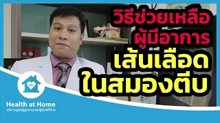 อาการของภาวะเส้นเลือดสมองตีบหรือแตกมีอะไรบ้าง
