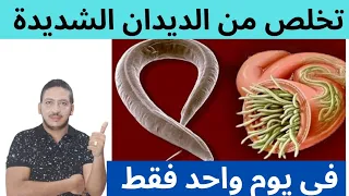 يوم واحد وسترى الديدان تقذف من أمعائك   علاج الديدان الدبوسية والشريطية والاسطوانية والاسكارس دندنها