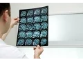Getting a Second Opinion ABTA s