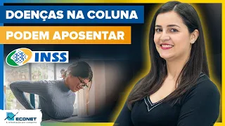 APOSENTADORIA PARA QUEM TEM DOENÇAS DE COLUNA | SAIBA COMO