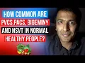 How common are PVCs PACs NSVT and Bigeminy in otherwise completely healthy normal people