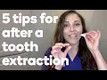 5 things to do after your tooth is extracted