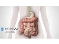 IBS symptoms the low FODMAP diet and the Monash app that can help