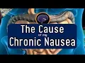 The Cause of my Mysterious Chronic Nausea ALifeLearned
