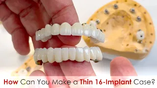 How Can You Make An Exceptionally Thin 16-Implant Full-Mouth Restoration?