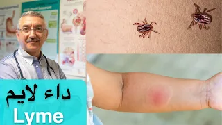                                       دندنها