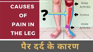 Download Causes of Leg Pain | Shin Splint | Calf strain | Sciatica | Varicose Veins | पैर में दर्द के कारण MP3