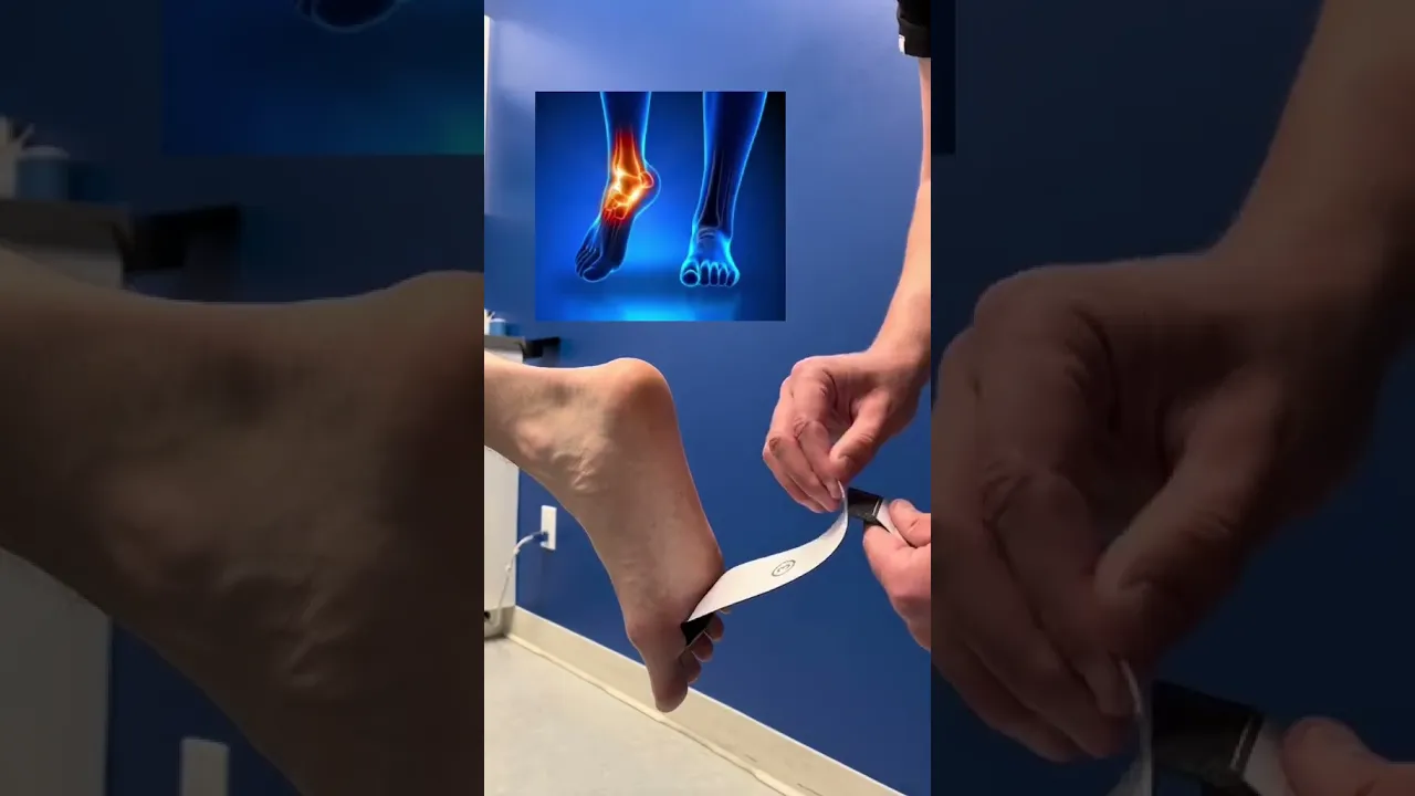 Taping The Ankle.