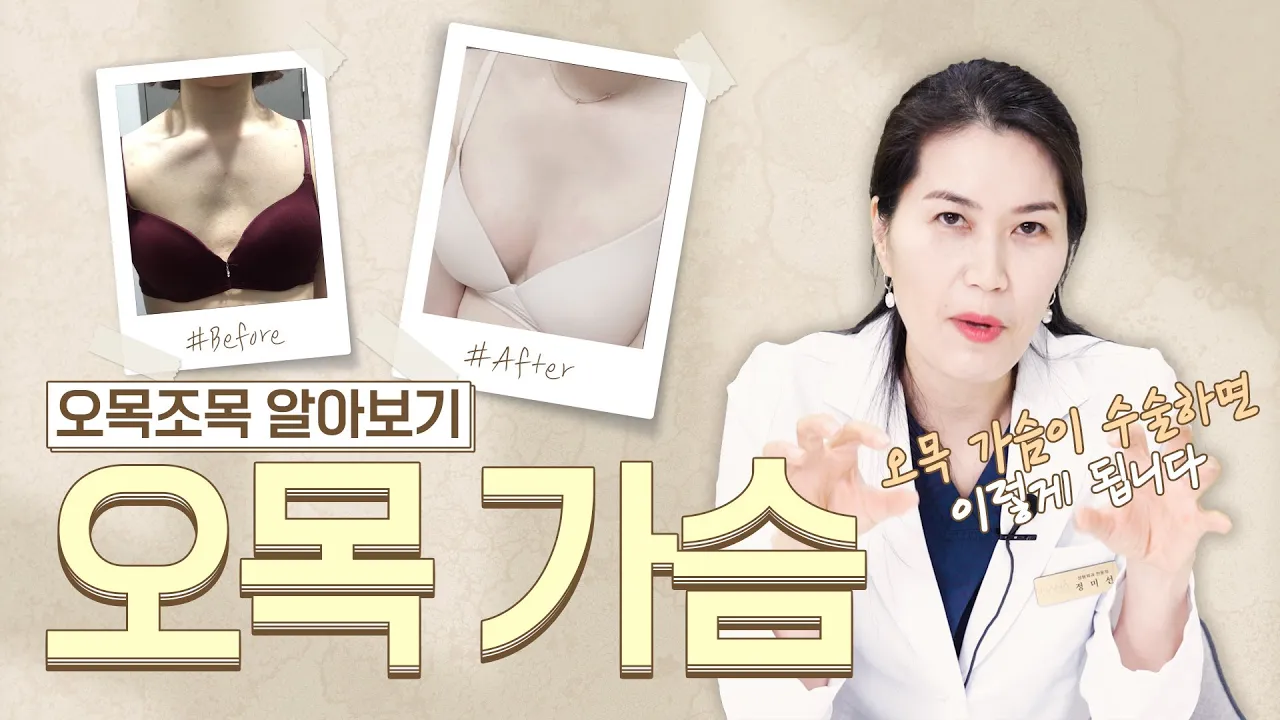 [가슴 수술] 오목 가슴이 뭘까?🤔특징&수술방법 오목조목 알아보기!