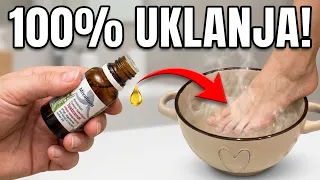 Bacite tablete! Ovo 100% Uklanja Gljivice na Noktima nogu..