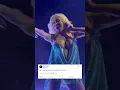 Doja Cat has capsular contracture