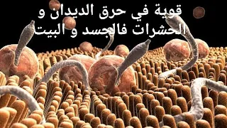 رقية قوية لحرق الديدان و الحشرات من شياطين خدام العين و الحسد و الأسحار 