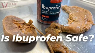 what ibuprofen does to the body
