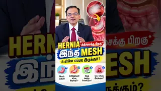 🤔 **Hernia Surgeryக்குப் பிறகு Mesh எதற்காக வைக்கிறார்கள்?**