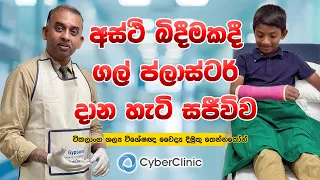 අස්ථි බිඳීමකදී ප්ලාස්ටර් දාන හැටි සජීවිව Cyber Clinic